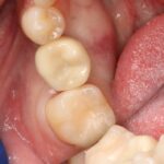 Concierge Dental Group Williamsville - Photo 6