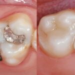 Tammy Perison, DDS Family & Cosmetic Dental Care - Photo 5