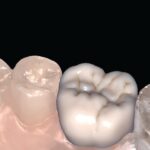 Evolution Dental Lab - Photo 3