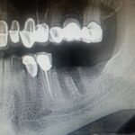 Affordable General Dentistry & Implants - Photo 1