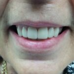 Affordable General Dentistry & Implants - Photo 4