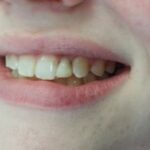 Affordable General Dentistry & Implants - Photo 7