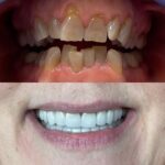 Buffalo General Dentistry | Implant, Sedation & Cosmetic - Photo 2