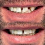 Buffalo General Dentistry | Implant, Sedation & Cosmetic - Photo 3