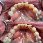 Buffalo General Dentistry | Implant, Sedation & Cosmetic - Photo 4