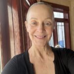 Samuel Shatkin Jr., MD - Plastic Surgeon - Photo 3