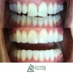 Spinelli Dental - Photo 5