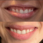 Dr. Violeta Garcia-Lepore Family Dentistry - Photo 6