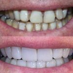 Village Smiles Family Dentistry - Photo 6