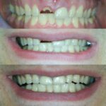 CrossKeys Dental - Photo 6