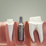 Calm Dental P.C. - Photo 7