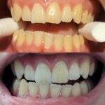 Platinum Smiles - Photo 1