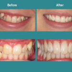 Dr.K Dental Albany - Photo 3