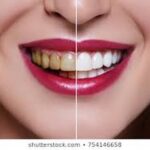 Family And Cosmetic Dentistry - Photo 2