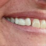 1st Advantage Dental - Bethlehem - Photo 3