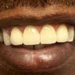 University Dental Associates - Photo 2