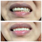 University Dental Associates - Photo 7