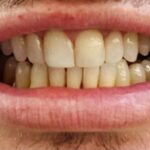 Third Avenue Bronx Dental P.C. - Photo 4