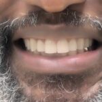 The Smilist Dental - Allerton - Photo 3