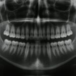 Εmergеncy Dеntist Brоnx - Photo 7