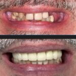 Dental Group NY - Bronx - Photo 6