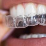 Morris Park Dental: Dr. Austin Le, DDS, MSc, Board-Certified Orthodontist - Photo 1