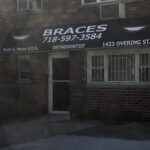 Braces - Photo 1