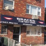 Braces - Photo 6