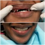 Cohen's Gentle Dental: Ofer Cohen, DDS - Photo 4