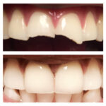Cohen's Gentle Dental: Ofer Cohen, DDS - Photo 5
