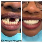 Cohen's Gentle Dental: Ofer Cohen, DDS - Photo 6