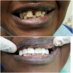 Cohen's Gentle Dental: Ofer Cohen, DDS - Photo 7