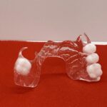 Thermoplastic Dental Lab - Photo 2