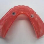 Thermoplastic Dental Lab - Photo 5