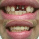 Cohen's Gentle Dental - Photo 6