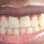 Diamond Braces Orthodontist: Braces & Invisalign - Photo 6